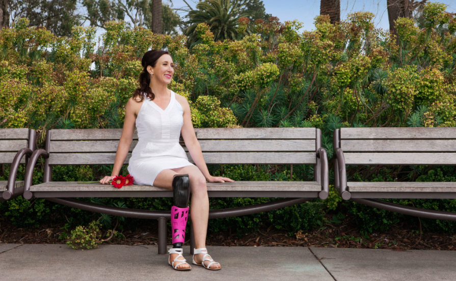 Amputee Develops 3d Printing Prosthetics Cover Patient Innovation