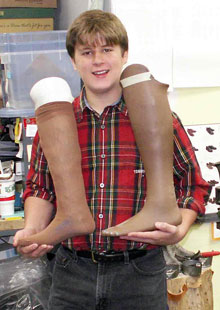 Teen creates device for his mother’s prosthetics | Patient Innovation