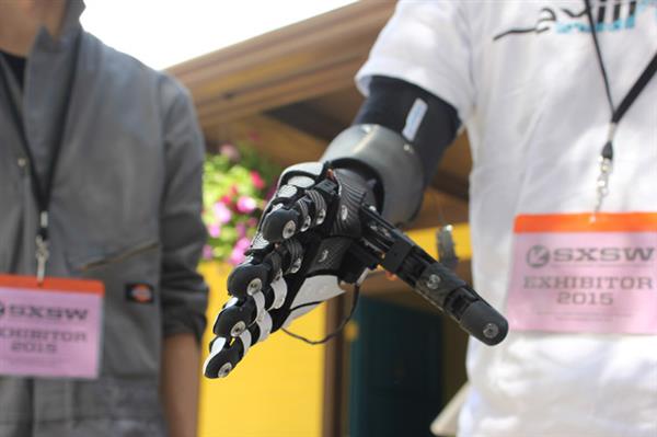 Myoelectric prosthetic 3D printing hand | Patient Innovation