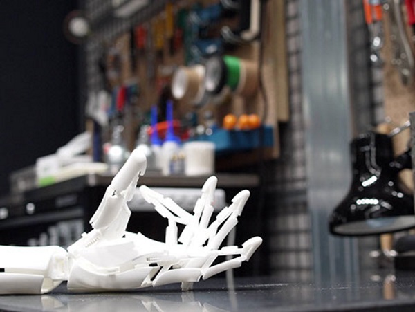 Myoelectric prosthetic 3D printing hand | Patient Innovation