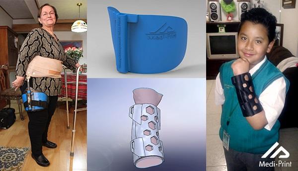 Man invents 3D printed cast for his mother | Patient Innovation
